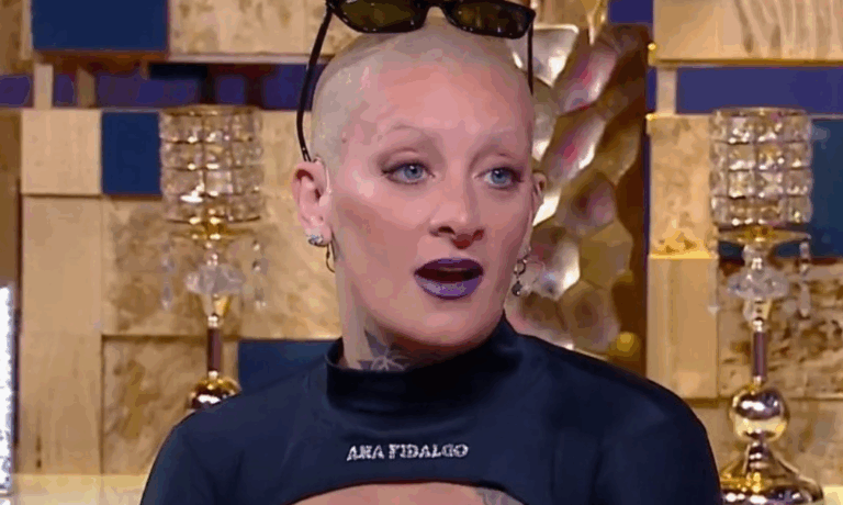 Las fotos del impactante nuevo rostro de Furia Scaglione tras operarse la nariz